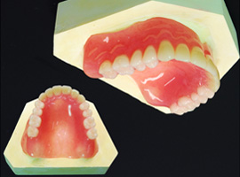 部分入れ歯